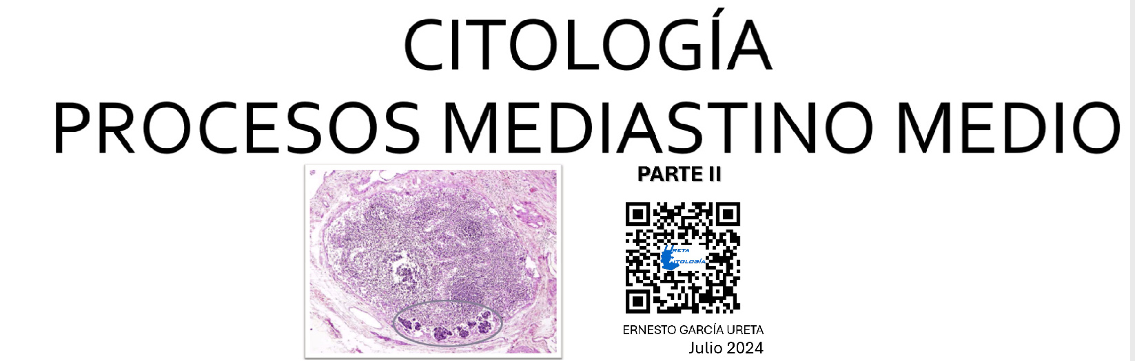 Citología de “Mediastino Medio” Parte II