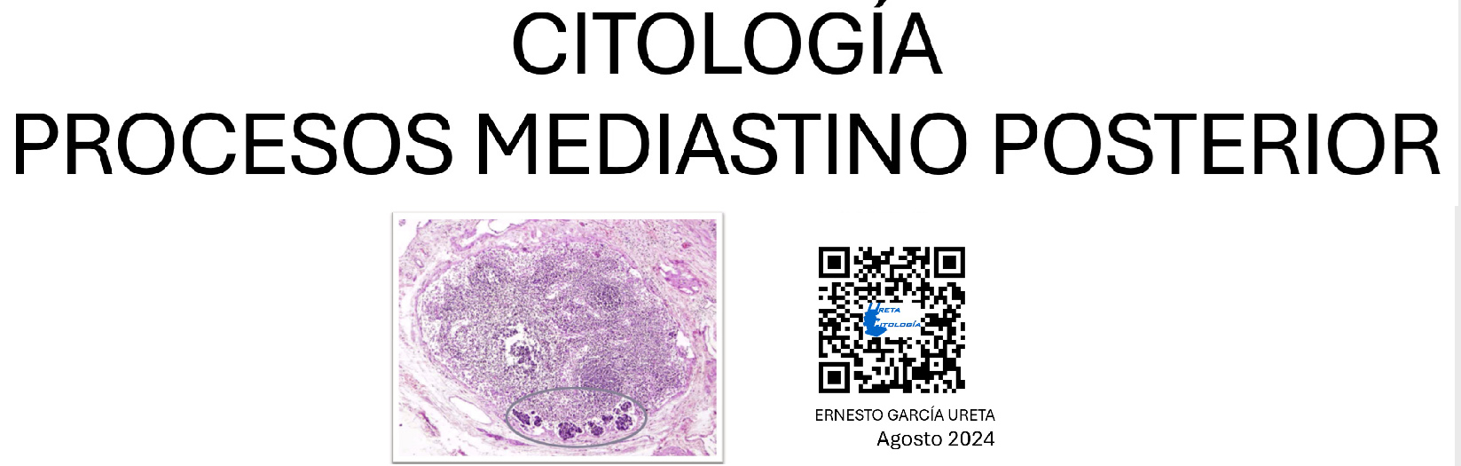 Citología de “Mediastino Posterior”