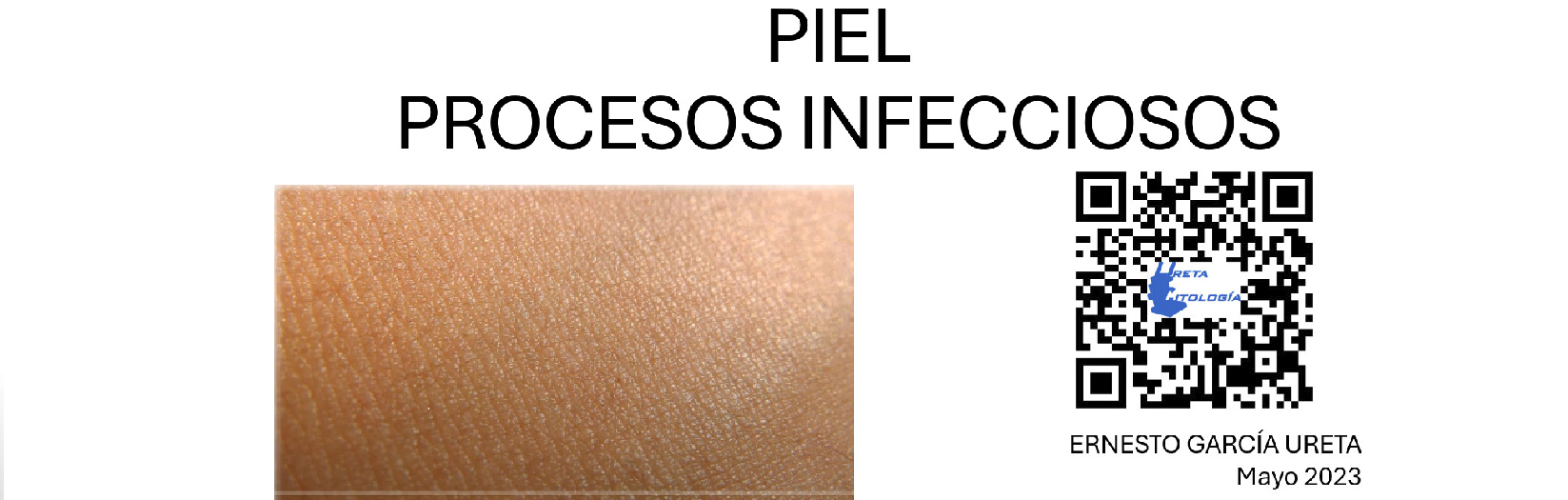 Citología de “Piel – Procesos Infecciosos”