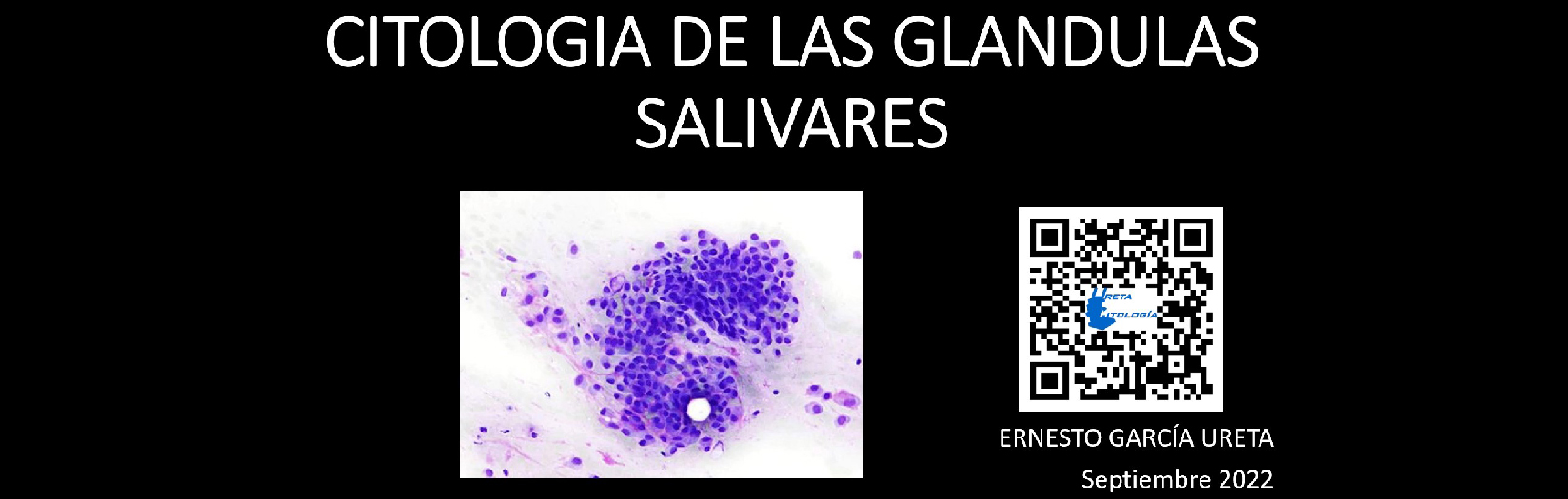 Citología de las Glándulas Salivales