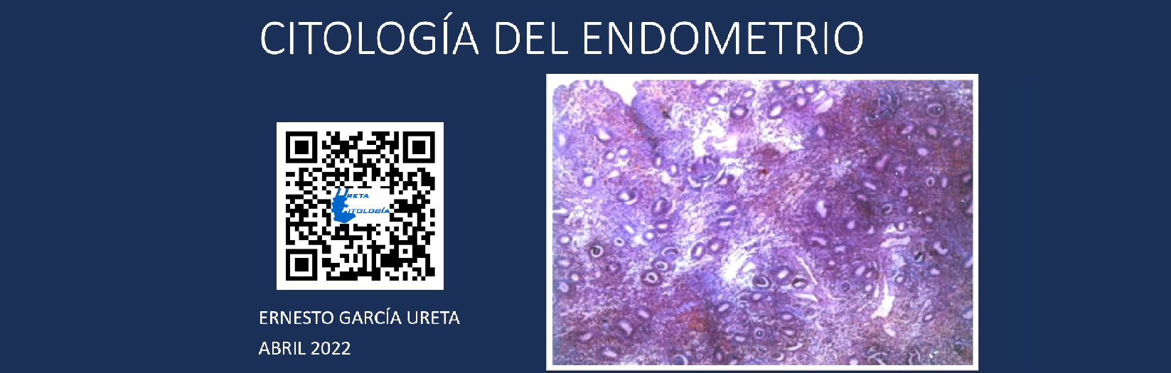 Citología del endometrio