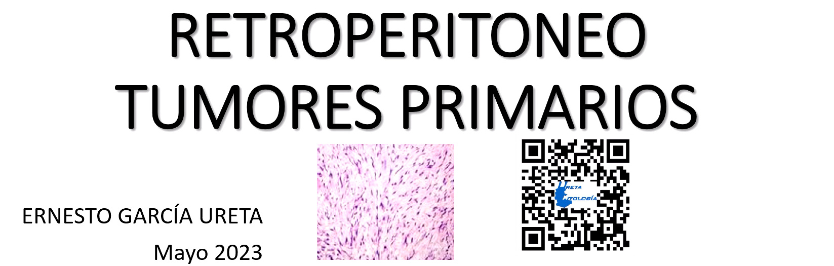 Citología tumores primarios del retroperitoneo